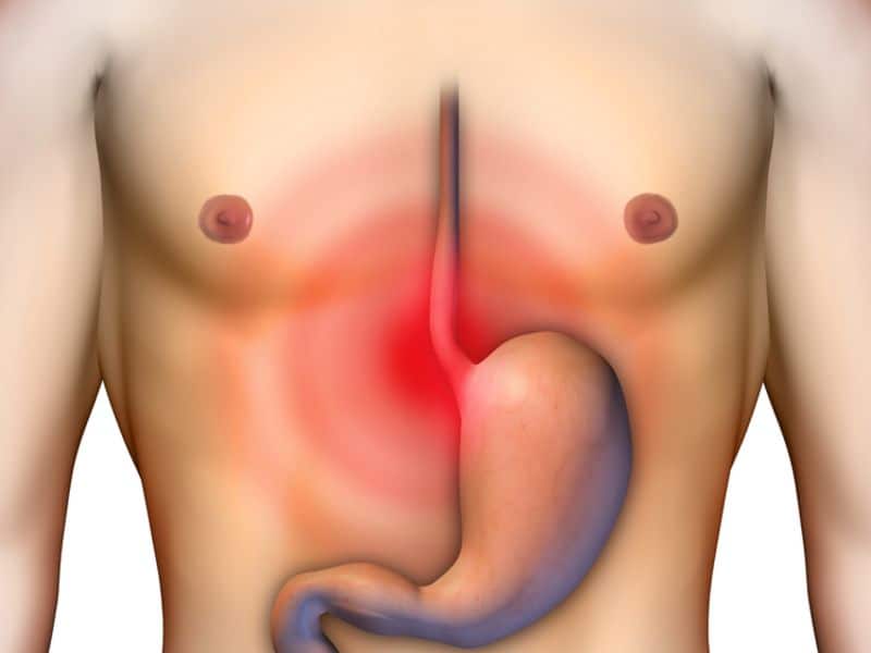 Stomach Acid Avoid These to Maintain Digestive Health